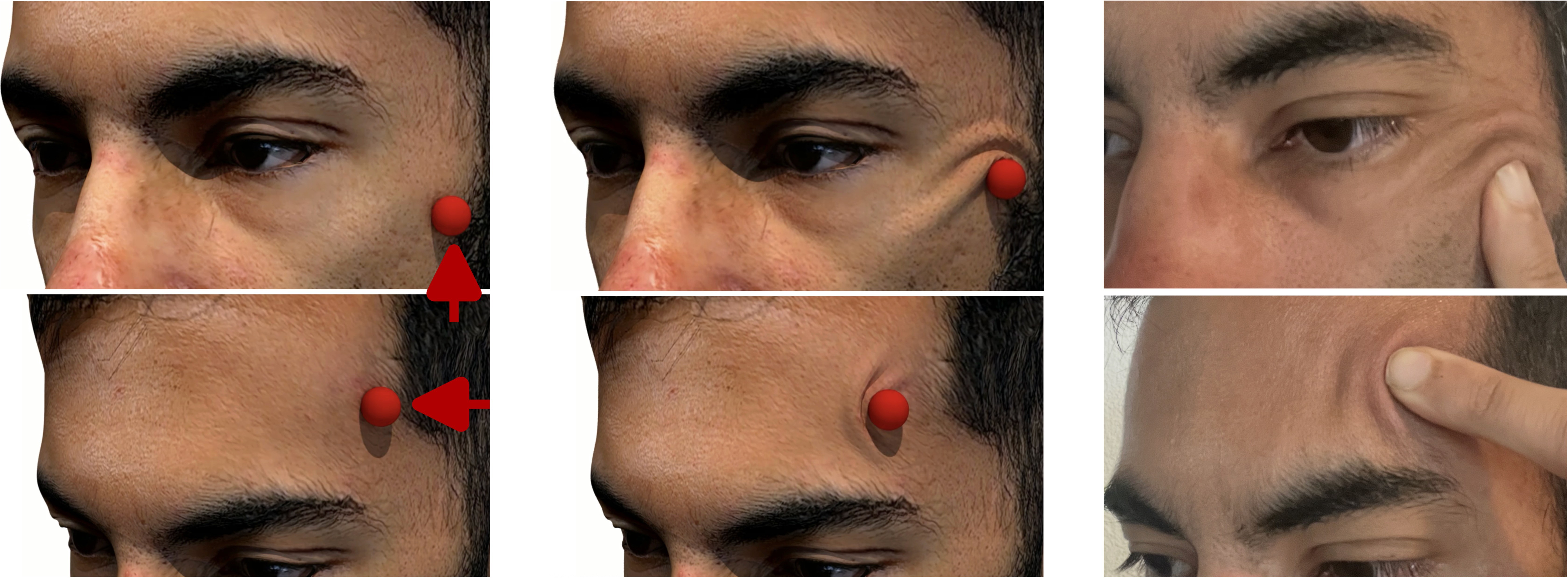 Physics-Based Simulation of Contact-Induced Facial Wrinkling