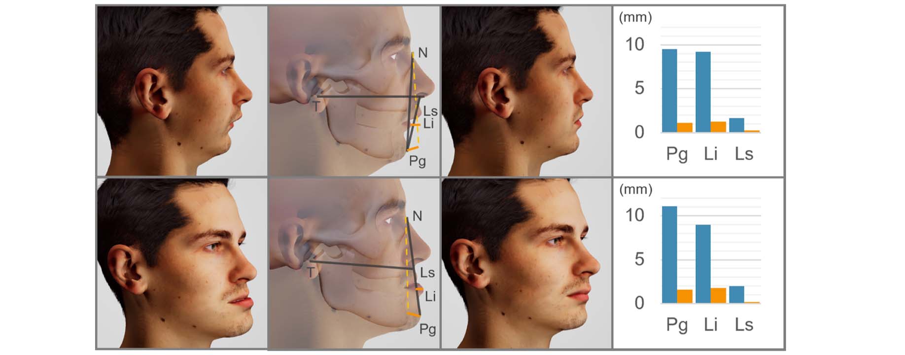 Differentiable Biomechanical Simulation